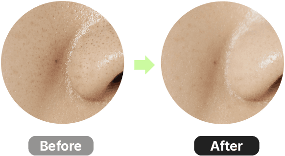 Before > After